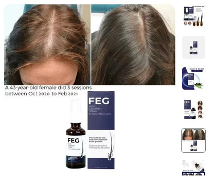 FEG Hair Growth Spray – Advanced Hair Regrowth Treatment for Thicker, Fuller & Stronger Hair
